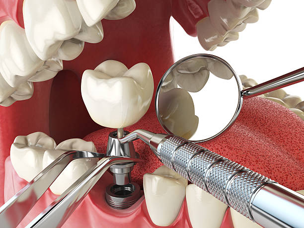 Best Cosmetic Emergency Dentistry in Ellicott City, MD